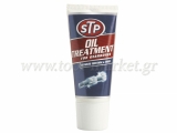 STP - Improver gear oil 150ml - Additives - Repair Systems